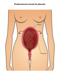 Positionnement normal du placenta